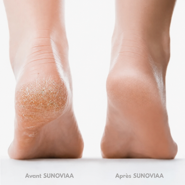 SUNOVIAA Silk 3 Pro